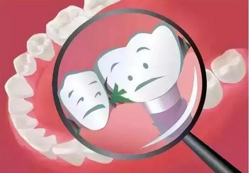 為什么吃東西老塞牙？小心這些??！  