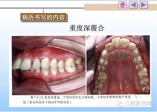 口腔正畸學病歷書寫  