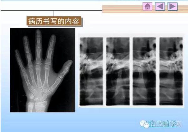 口腔正畸學病歷書寫  