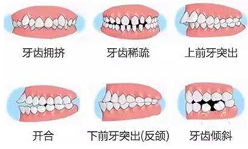 關(guān)于牙齒矯正，你想知道的都在這！