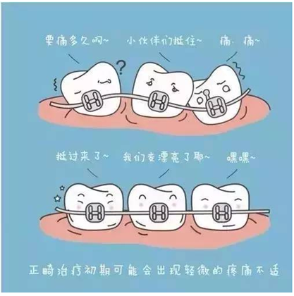 關(guān)于牙齒矯正，你想知道的都在這！