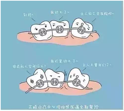 關(guān)于牙齒矯正，你想知道的都在這！