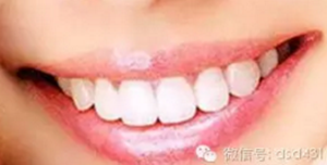 是什么導(dǎo)致了義齒返工？？？