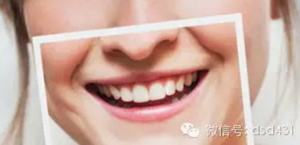 是什么導(dǎo)致了義齒返工？