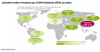 種植體，在全球牙科設備市場的變化！
