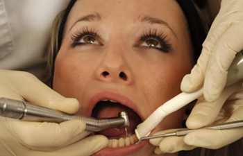 完全不懂，各種補牙材料，到底怎么選？