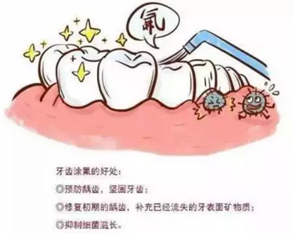 涂氟還是窩溝封閉？到底該給孩子做哪個？