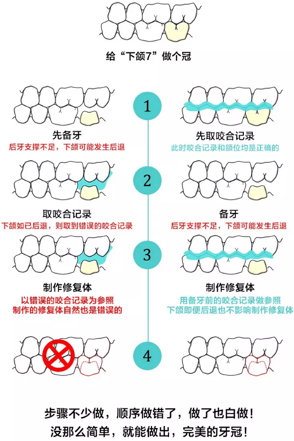 咬合記錄的對與錯(cuò)