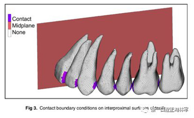 正畸文獻閱讀--對于滑動法關(guān)閉間隙的有限元分析
