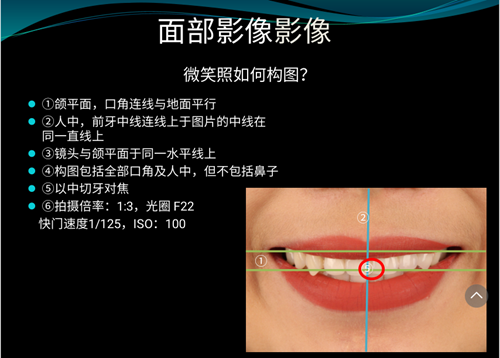 口內(nèi)照攝影方法與技巧分享