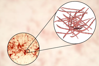 食道癌？胰腺癌？腸道疾??？口腔微生物們做了什么！