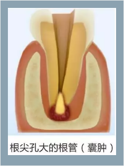 多頻技術(shù)的根管長度測定儀