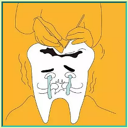 補(bǔ)牙后注意事項