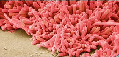 牙菌斑是什么？