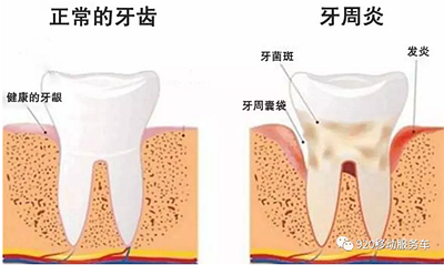 什么是牙齦萎縮？