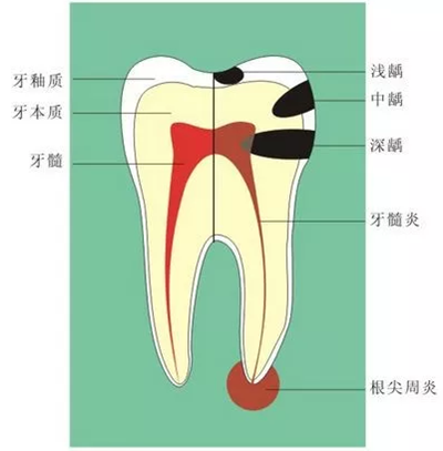 什么是牙齦萎縮？