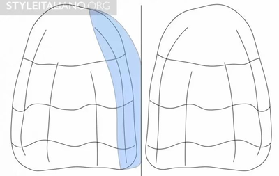 【分享】前翼技術關閉前牙間隙