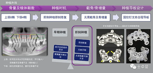 【病例分享】應(yīng)用全程數(shù)字化對(duì)牙周炎患者實(shí)現(xiàn)全口即刻種植即刻修復(fù)